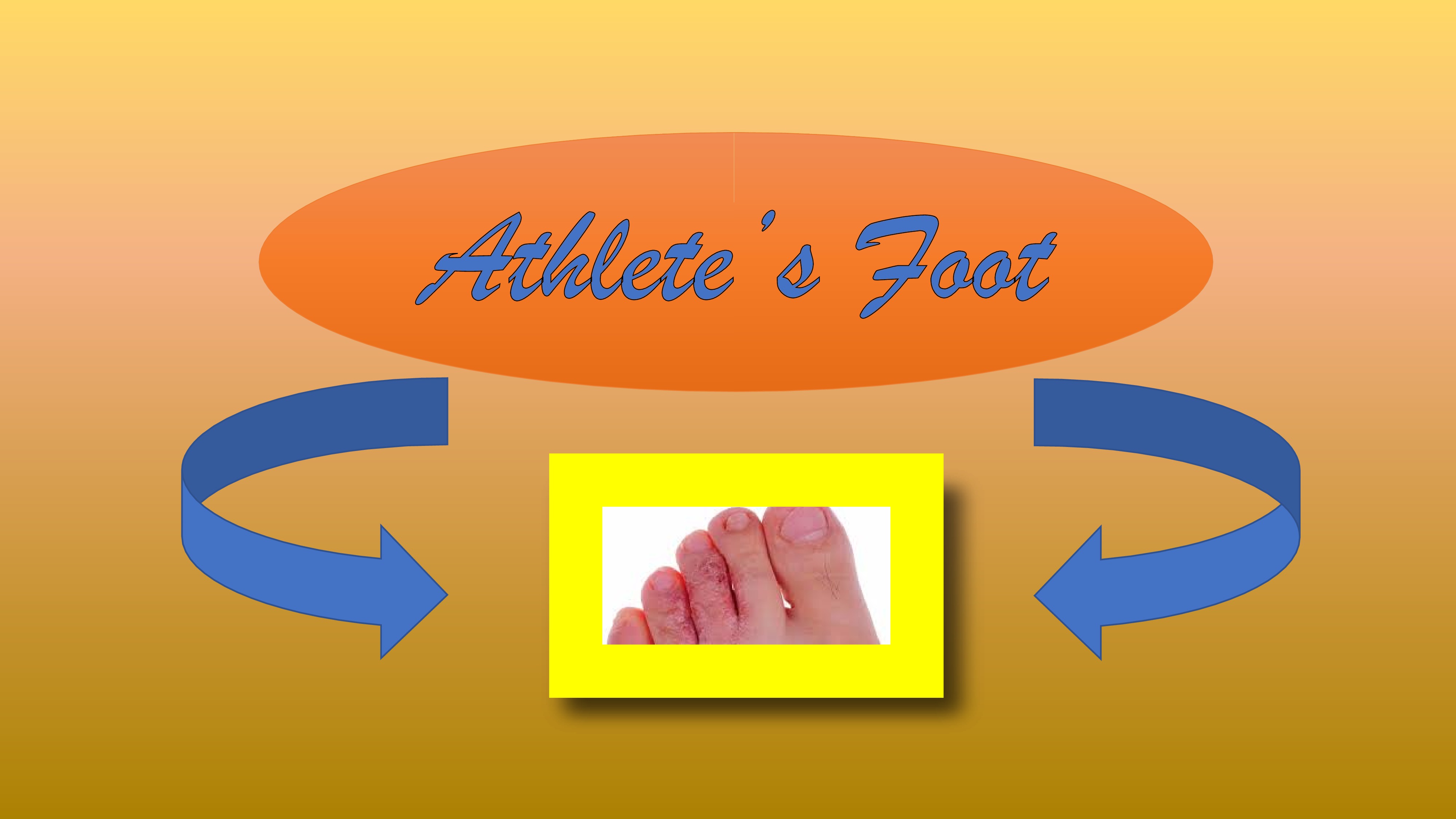 Athlete's Foot